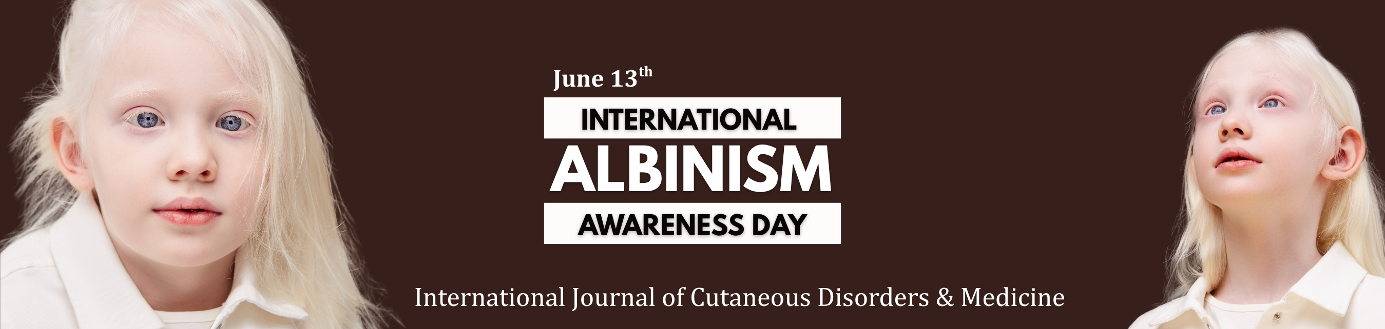 Albinism